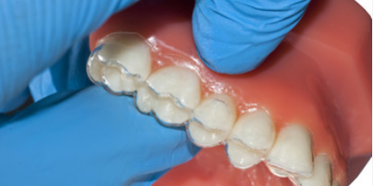 Teeth Straightening Leeds