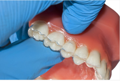 Teeth Straightening Leeds