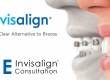 Invisalign Leeds