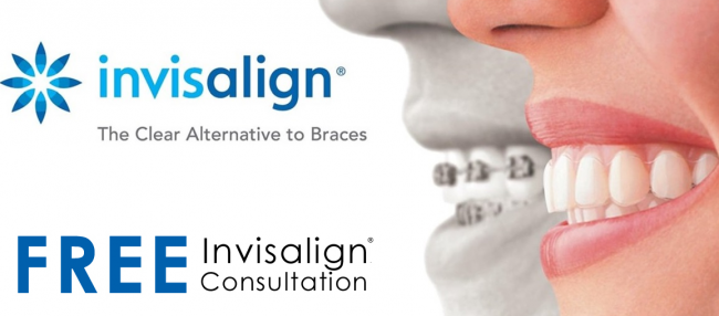 Invisalign Leeds